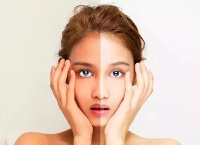 Cận cảnh làn da bị cháy nắng, so sánh vùng có kem chống nắng và vùng không được bảo vệ.